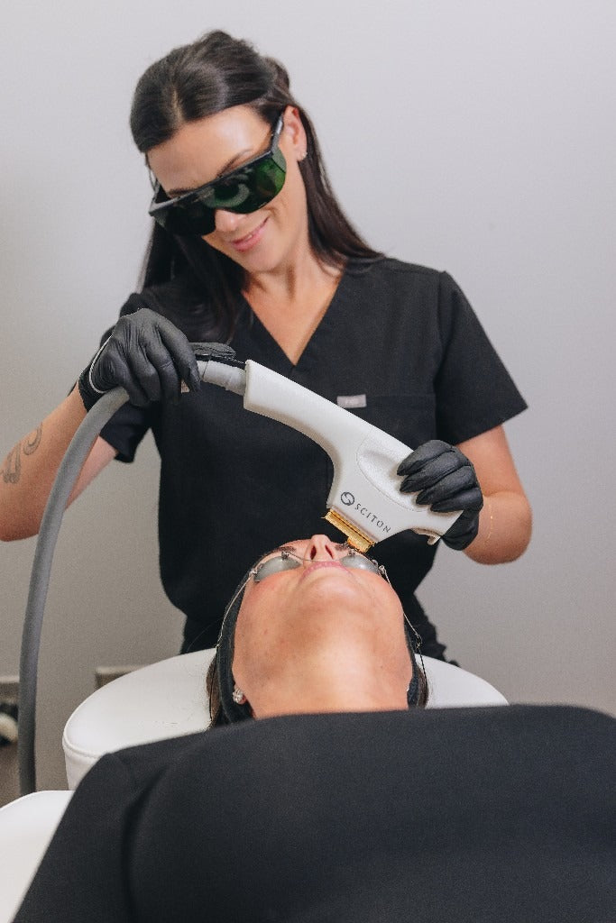 BBL Laser Treatment